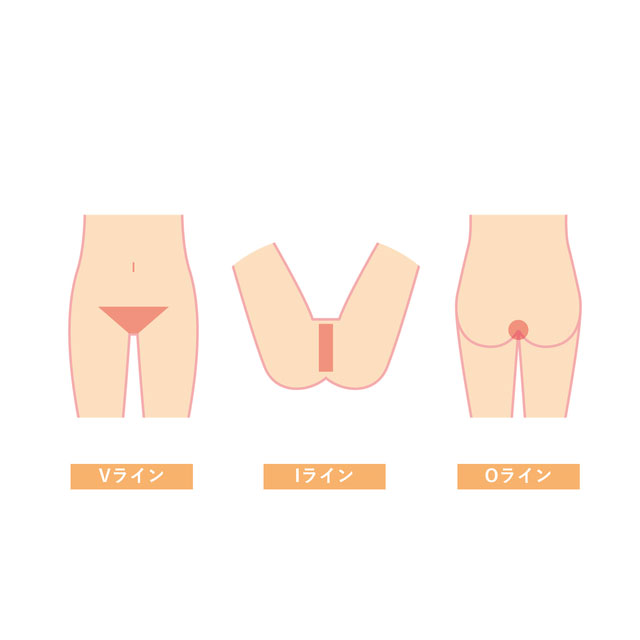 VIOセットメニュー